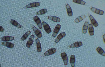 Conidia of the pathogen of grape branch blight